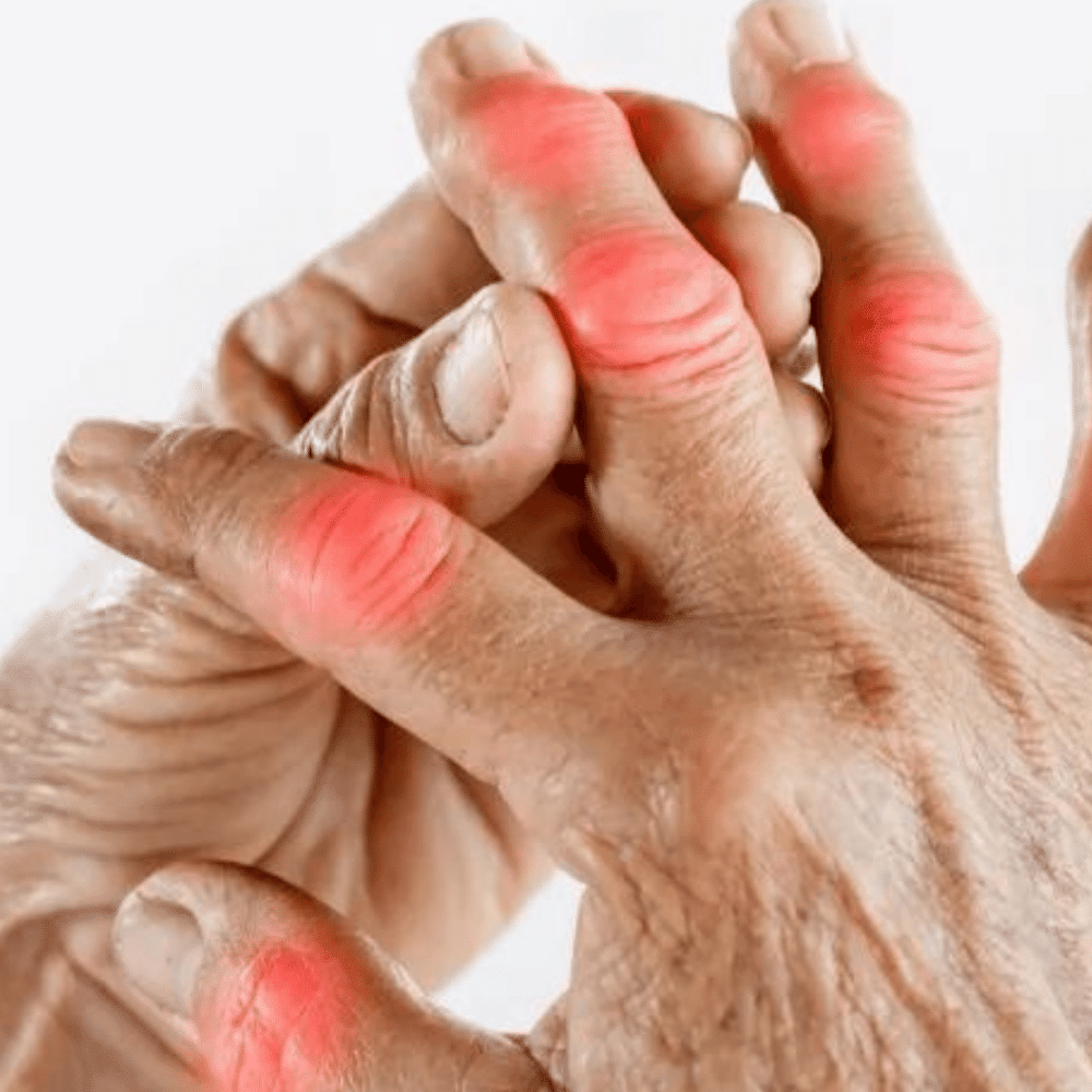 Best Arthritis Supplements