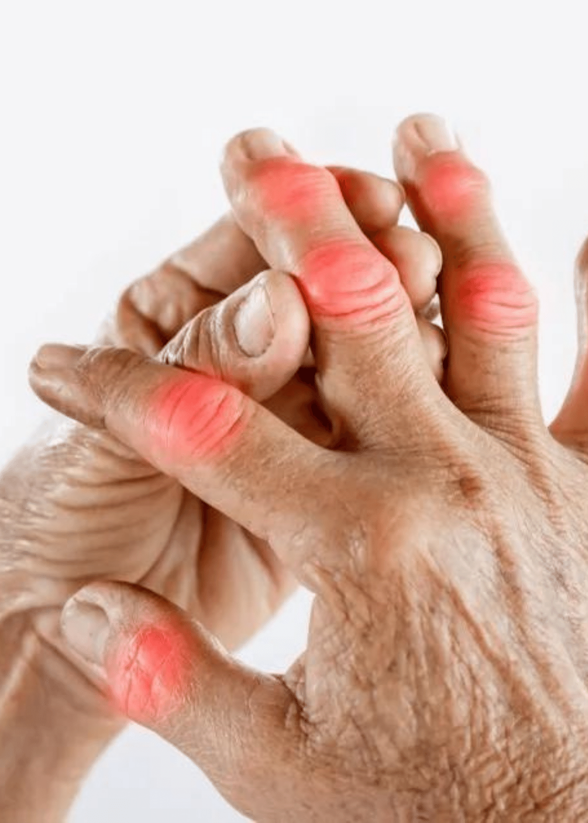 Best Arthritis supplement